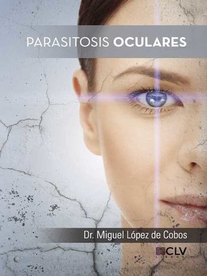 cover image of Parasitosis oculares
